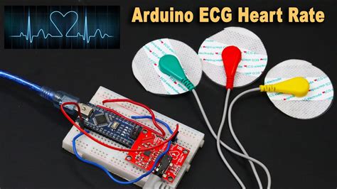 ecg porn|ecg Search